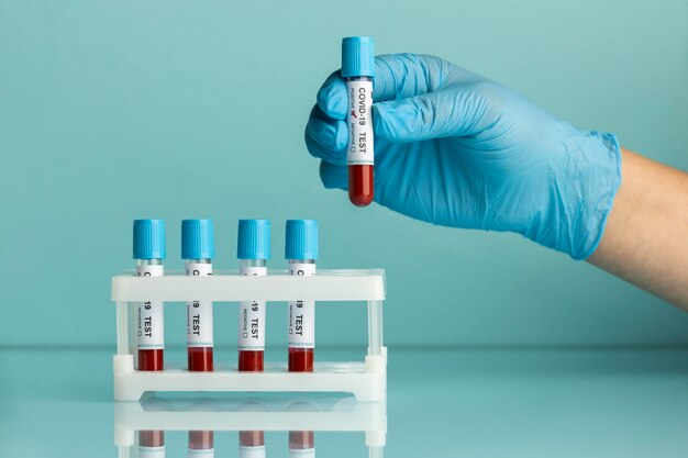 Hand with protective gloves holding a blood samples for covid test