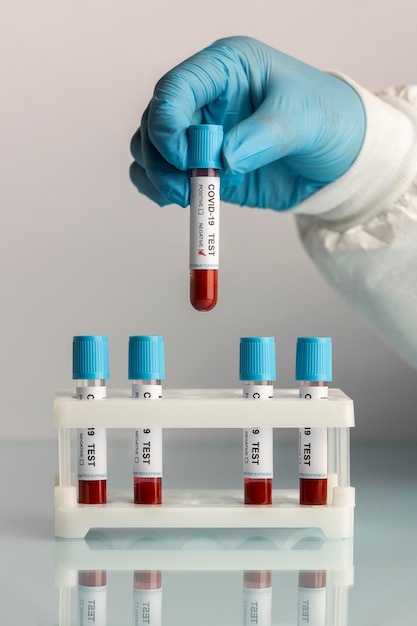 Hand with protective gloves holding a blood samples for covid test