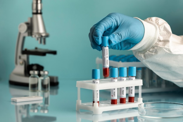 Hand with protective gloves holding a blood samples for covid test