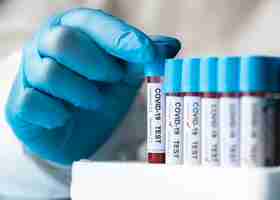 Free photo hand with protective gloves holding a blood samples for covid test