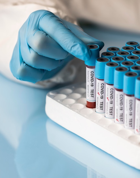 Free photo hand with protective gloves holding a blood samples for covid test