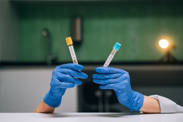 Hands in rubber gloves holds two test tube with coronavirus
