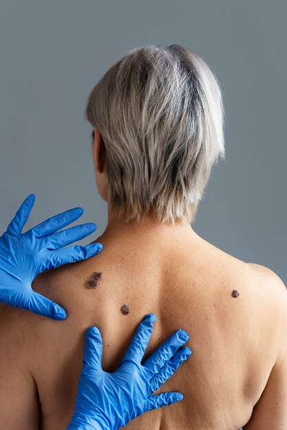hands with gloves touching skin with melanoma