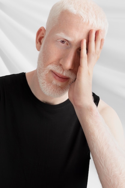 Free photo handsome albino man posing