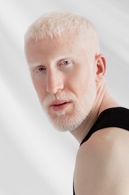 Free photo handsome albino man posing