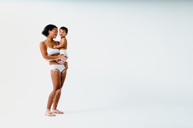 색색의 배경 위에 아기를 안고 있는 백반증을 가진 행복한 흑인 여성