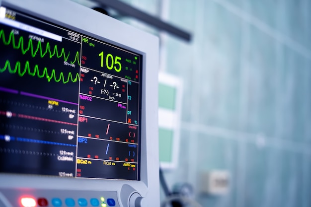 病室​の​心臓​モニター​画面​。