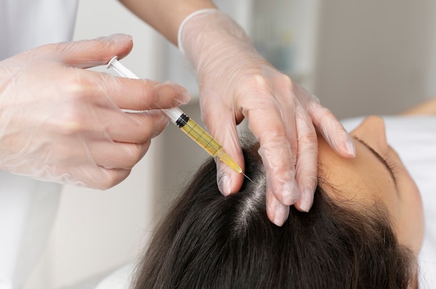 High angle woman getting scalp prp treatment