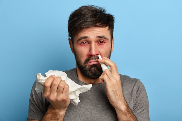 Hypersensive european man suffers from allergy, has red swelling eyes, inflammation of nose. sick man caught cold, uses nasal drops, holds handkerchief, symptoms of flu or fever, needs treatment