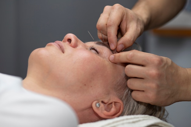 Free photo japanese traditional medicine with needles