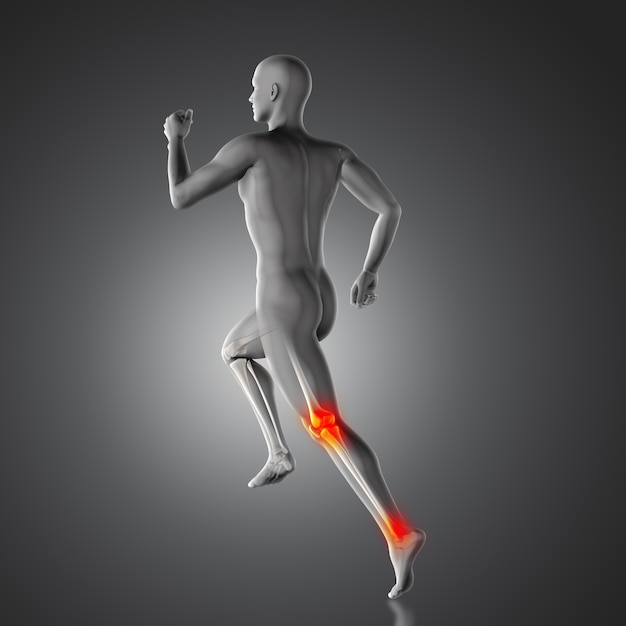 Knee pain and achilles heel