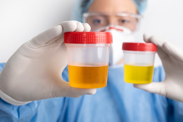 Lab doctor performing medical exam of urine