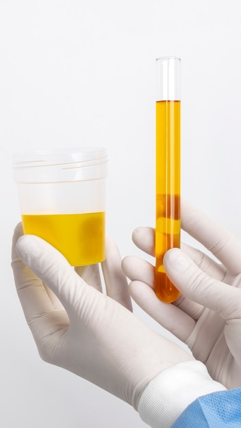 Lab doctor performing medical exam of urine