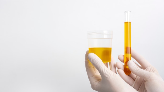 Foto gratuita medico di laboratorio che esegue esame medico delle urine