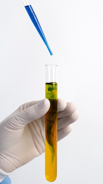 Lab doctor performing medical exam of urine