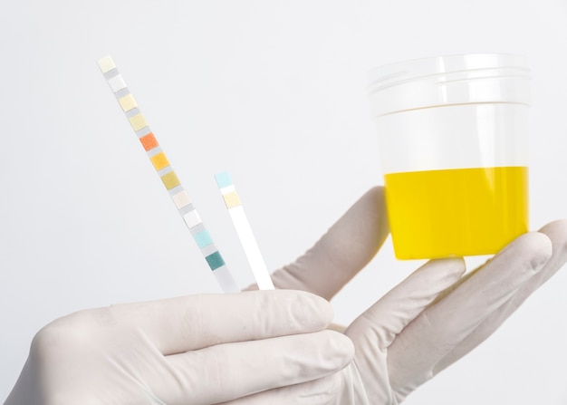 Lab doctor performing medical exam of urine