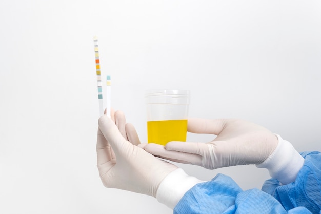 Lab doctor performing medical exam of urine