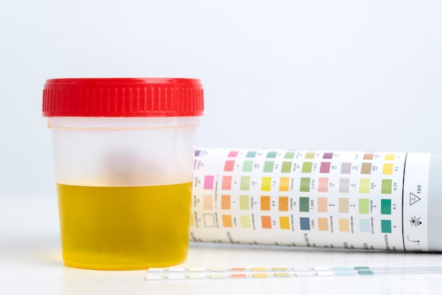Dog UTI Treatment: Method & Procedure 10 lab doctor performing medical exam of urine