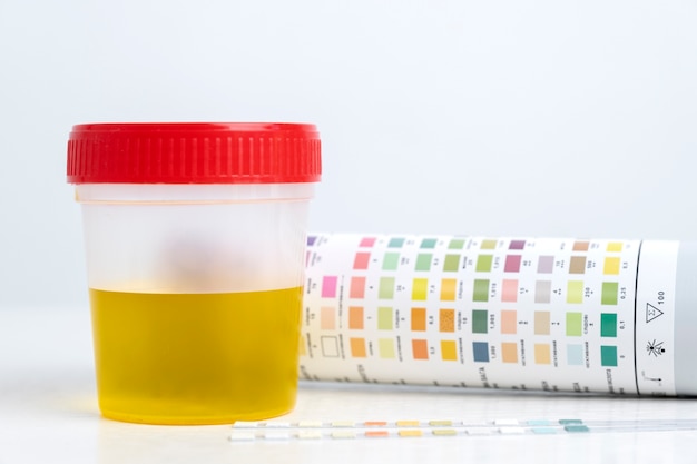 lab doctor performing medical exam of urine