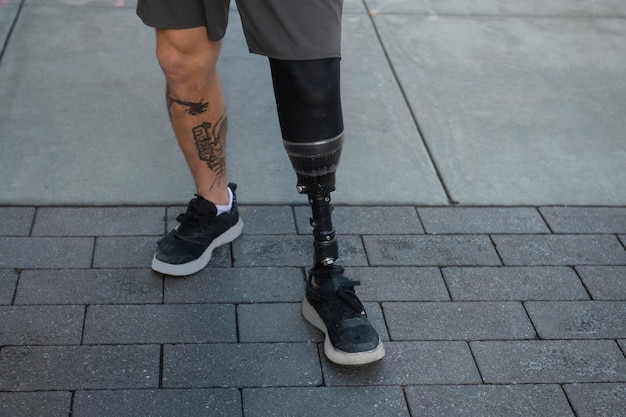 Legs of man with disability