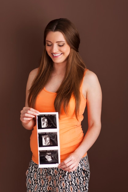 Free photo lovely pregnant woman with ultrasound scan