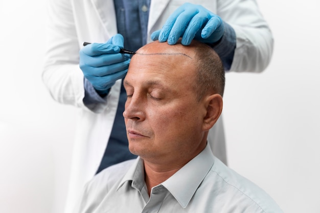 Male going through a follicular unit extraction process