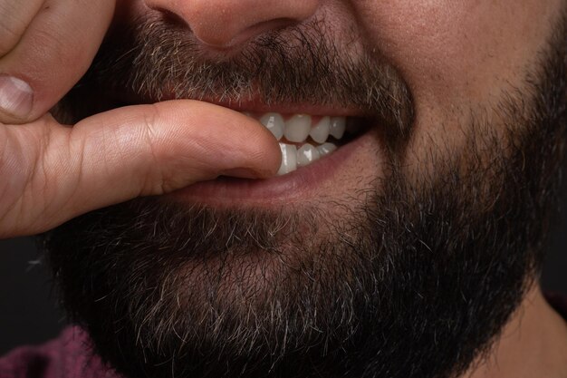 Male lips with untrimmed beard at closeup close up of male part of face man bites his nails bad habit