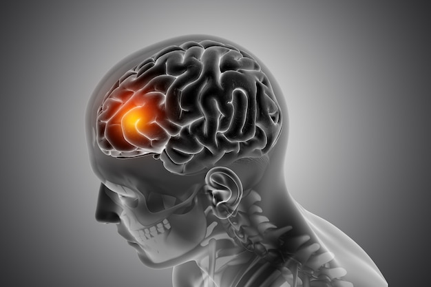 male medical figure with front of the brain highlighted