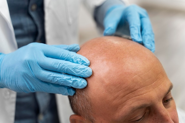 Man going through a follicular unit extraction process