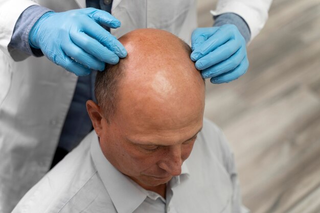 Man going through a follicular unit extraction process