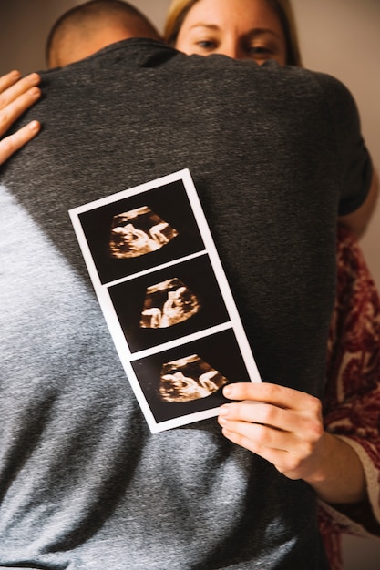 Man hugging woman holding ultrasound