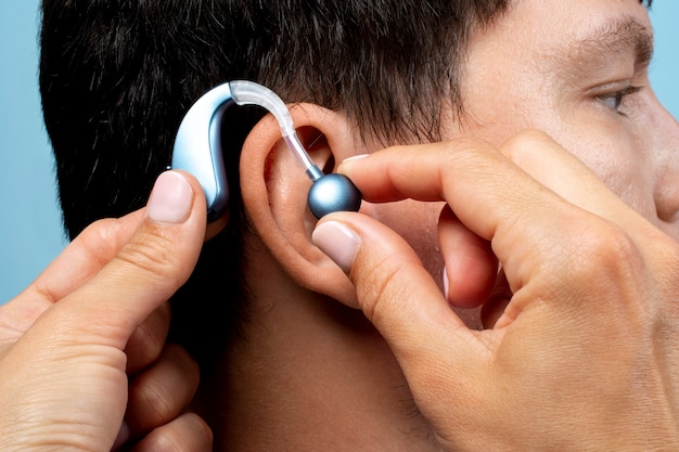 Cochlear Implant Recall