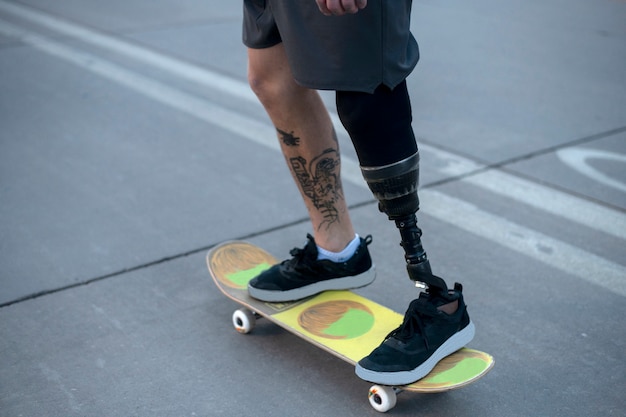 도시에서 다리 장애 스케이트보드를 타는 남자