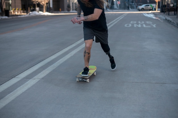 市内でスケートボードをしている足の障害を持つ男