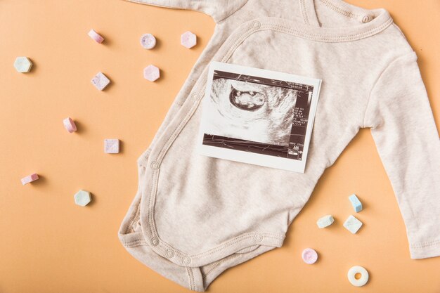 Many mint candies with sonography picture on baby onesie over an orange backdrop