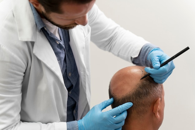 Mature man going through a follicular unit extraction process