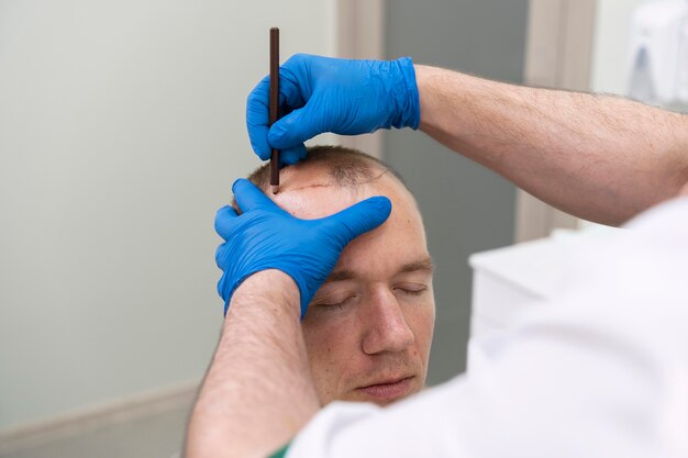 Mature man having balding problems