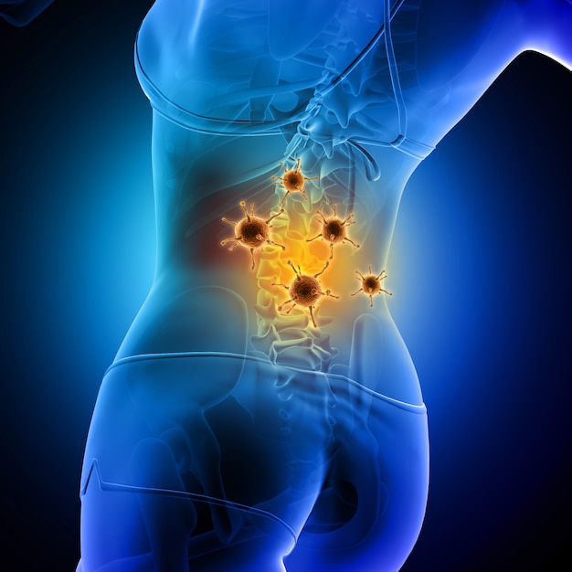 medical background of a female figure with spine highlighted and virus cells