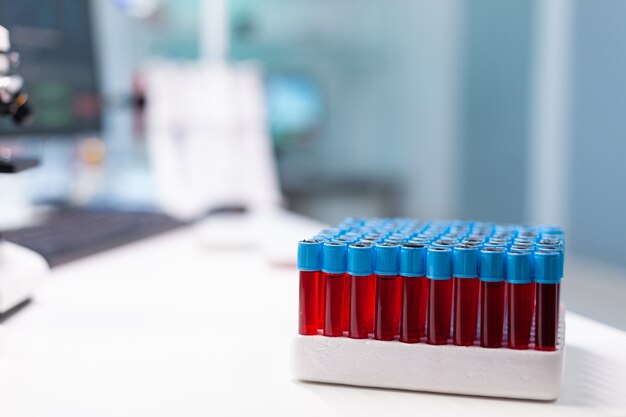 Medical vacutainer with blood sample standing on table during pharmaceutical examination