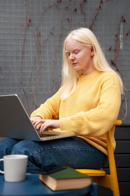 Free photo medium shot albino woman working with laptop