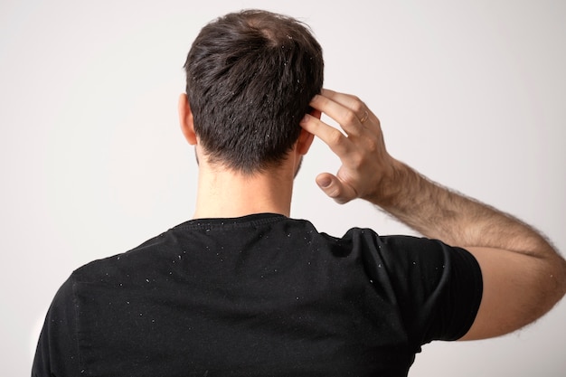 Medium shot man with dandruff problems back view