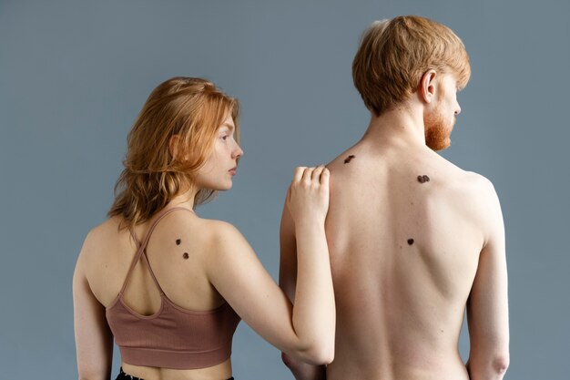 Medium shot man and woman with moles