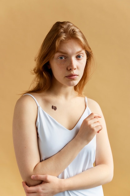 Medium shot young woman with mole