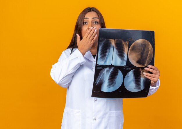 Middle aged woman doctor in white coat with stethoscope holding x-ray looking at front being shocked covering mouth with hand standing over orange wall