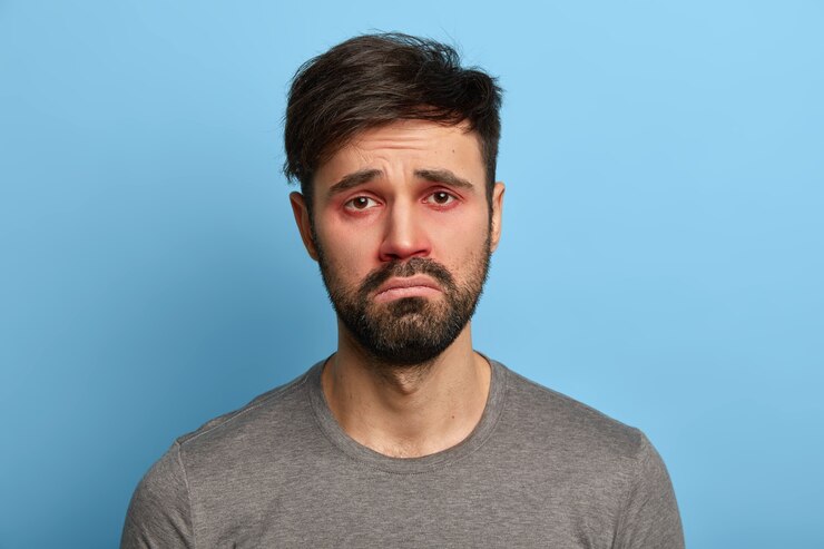 आई फ्लू क्या है ? 2 आई फ्लू क्या है ?
