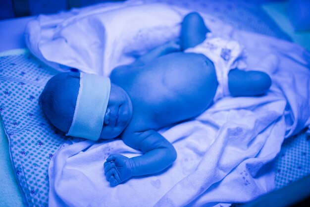 高ビリルビン血症を伴う新生児を見る母親 青紫色光下の新生児黄疸 プレミアム写真