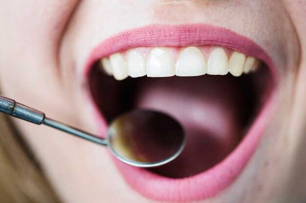 Open mouth of woman with dentist mirror