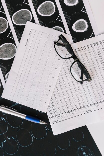Накладной просмотр МРТ-отчетов с отчетами; ручка и черные очки