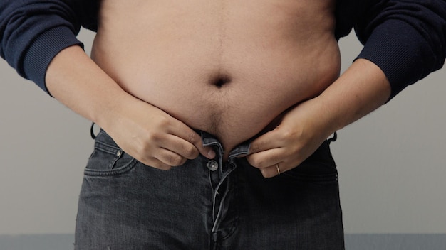 Бесплатное фото Мужчина с избыточным весом крупным планом живота сбоку надевает рубашку, щипает и хлопает в ладоши по животу
