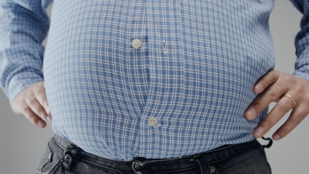 shrtの太りすぎの男性は、巨大な腹と開いたボタンで彼には小さいです